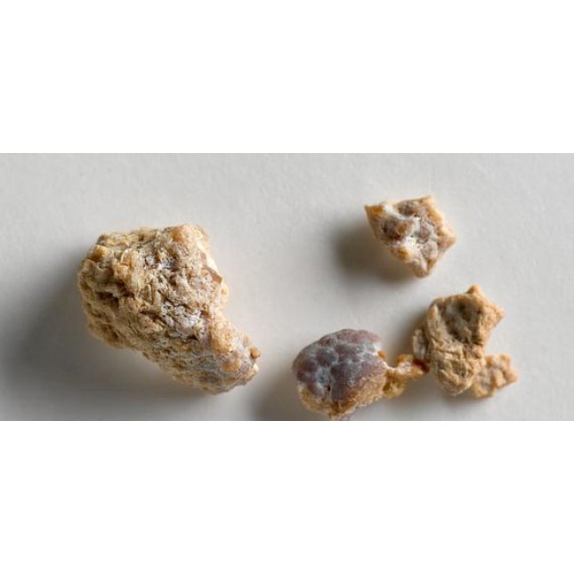 ΔΙΑΚΟΣΜΗΤΙΚΕΣ ΠΕΤΡΕΣ STONES PICTURE ΔΙΑΚΟΣΜΗΤΙΚΕΣ ΠΕΤΡΕΣ STONES PICTURE